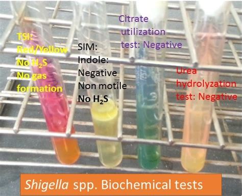 shigella sonnei biochemical test results|Shigella .